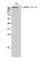 EGFR (phospho Tyr1172) Polyclonal Antibody